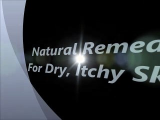helpful tips/ITCHY SKIN/DRY SKIN REMEDY