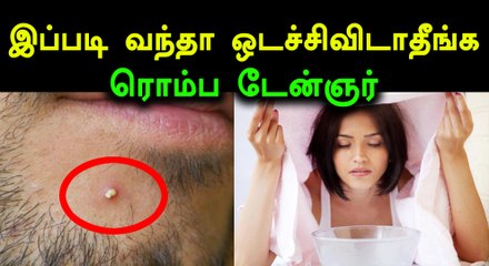 பரு வந்தா இத பண்ணுங்க.. ஒடைச்சா டேஞ்சர்