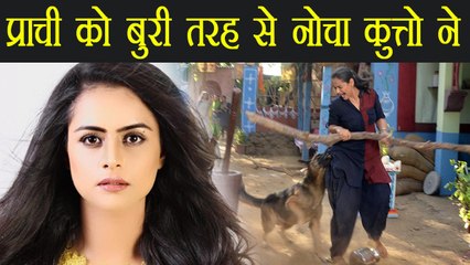 TV Actress Prachi Tehlan को शूटिंग के दौरान कुते ने बुरी तरह से नोचा | वनइंडिया हिंदी