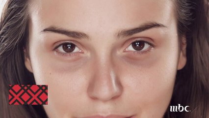 تعرفي على أكثر الطرق الآمنة لإزالة هالات  العين السوداء