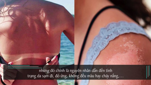 5 dấu hiệu tưởng bình thường nhưng đó là cách mà làn da đang “cầu cứu” bạn