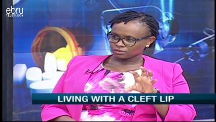 Food intake to avoid getting a baby with cleft lip