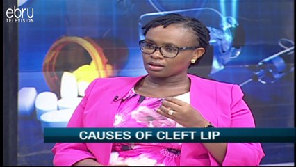 What causes or triggers cleft lip