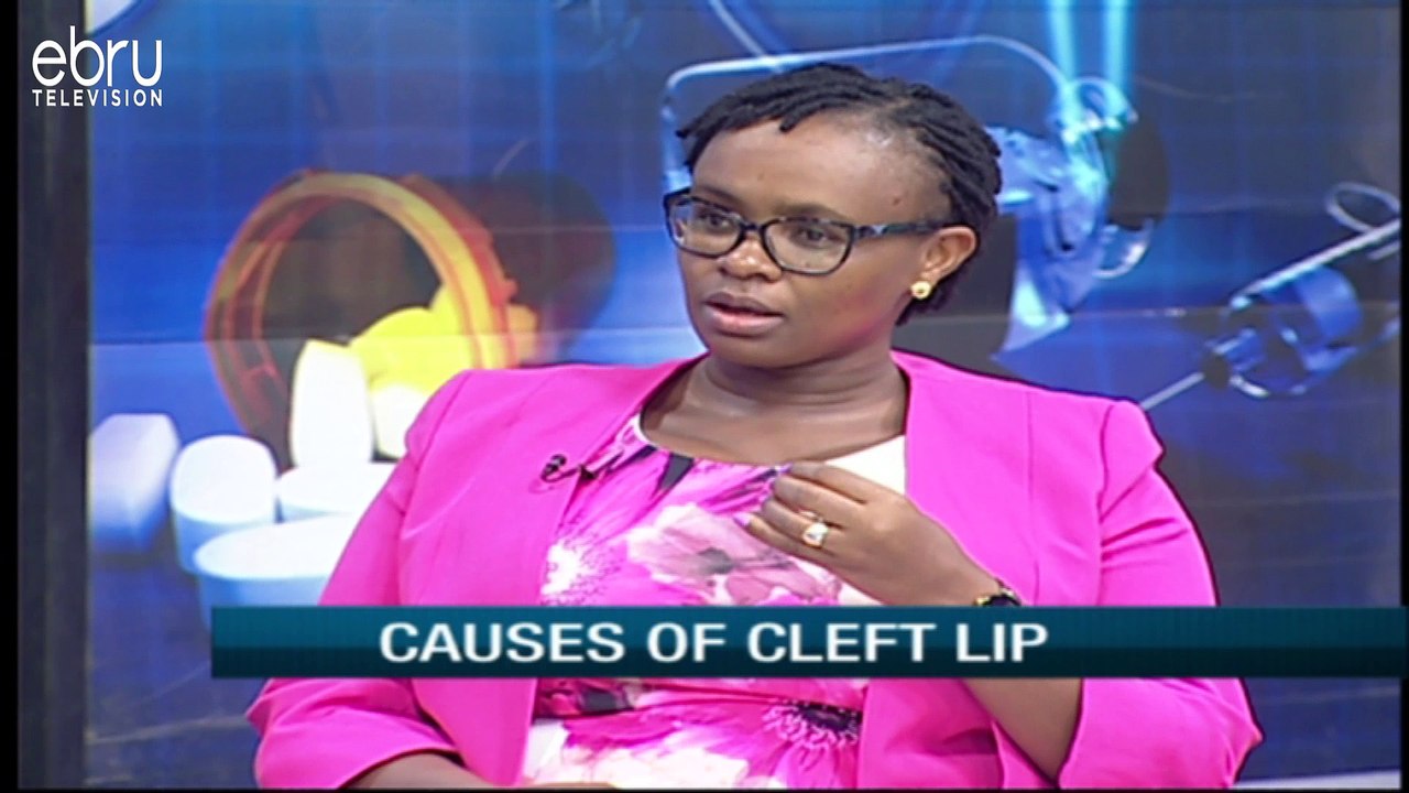 What causes or triggers cleft lip