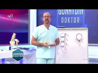 Op. Dr. Onur Kulaksizoglu | Fitik neden olusur? | 06.10.2017