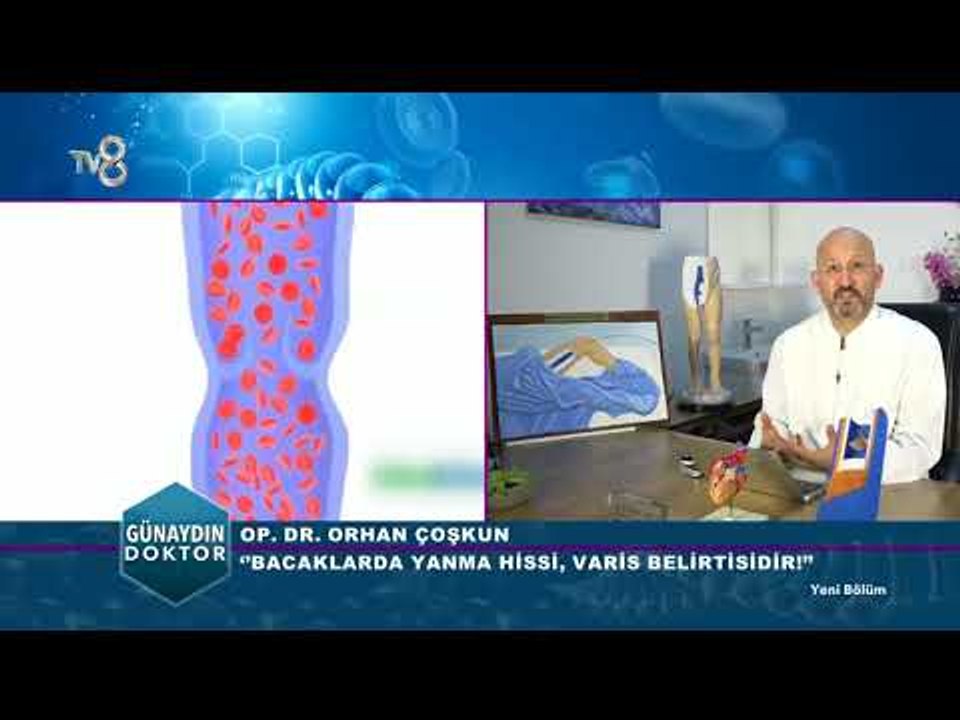 Varis nedir ve nasıl oluşur, belirtileri nelerdir?