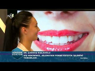 Pembe estetik ve bonding öncesi ve sonrası?