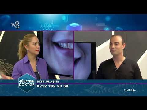 Bir Günde ve Birkaç Günde Yapılan Gülüş Tasarımı Nasıl Oluyor? | Günaydın Doktor