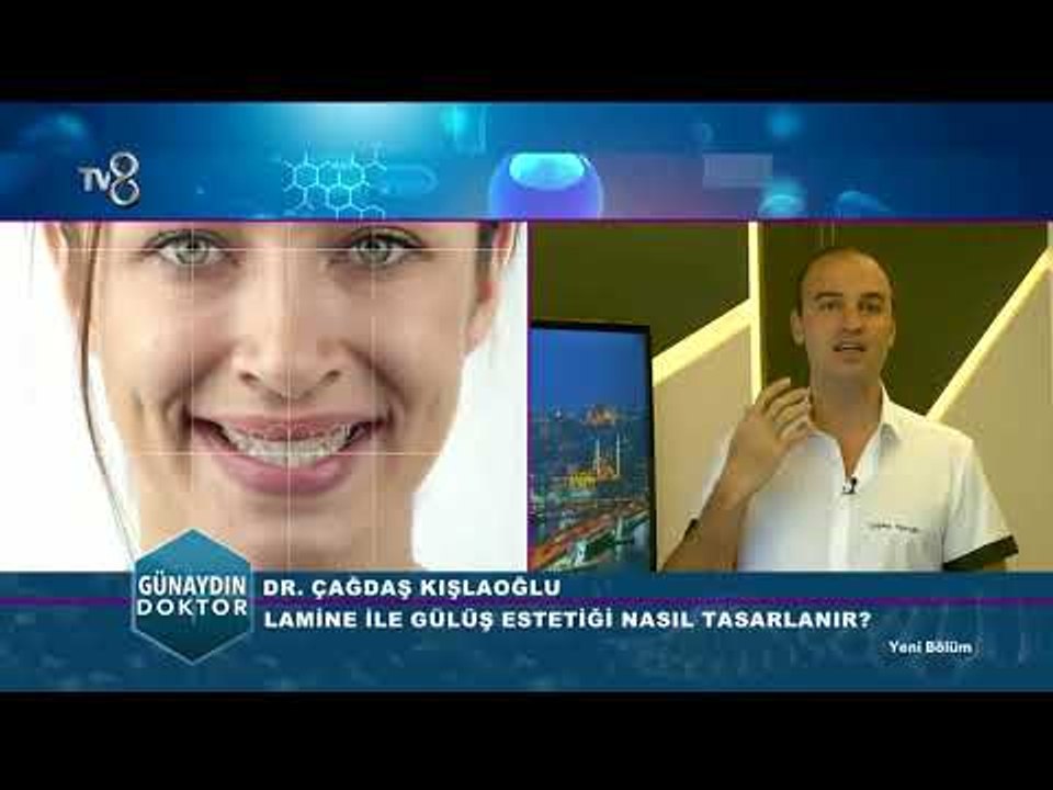 Gülüş Tasarımı ve Gülüş Tasarımında Kullanılan Malzemeler | Günaydın Doktor