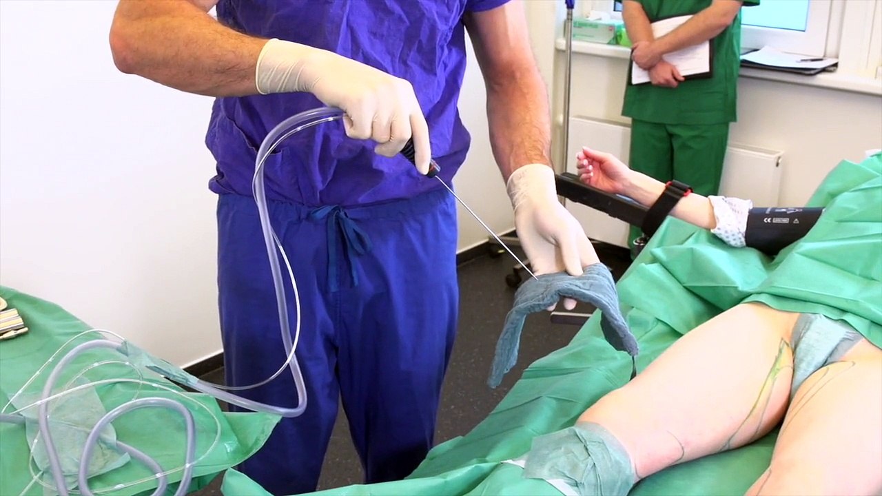Body-jet eco ile lipofilling yüz ve eller