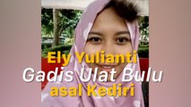 Ulat Bulu Berkeliaran di Wajah, Lihat yang Terjadi pada Gadis Ini