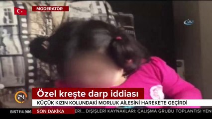3,5 yaşında kız çocuğunun kolundaki morluk tartışma konusu oldu