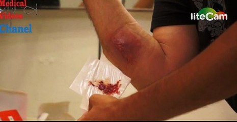 e pickoi merimanga, ja cfare i del