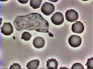 Glóbulo Blanco Persiguiendo a una Bacteria