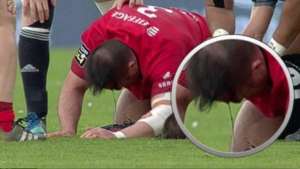 Un joueur lyonnais à la tête ensanglantée après un énorme contact