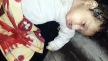 Esad rejimi Duma’ya kimyasal saldırı düzenledi: 75 ölü, 1000'den yaralı
