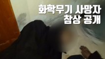 [자막뉴스] 입에 흰 거품 문 채...화학무기 사망자 참상 공개 / YTN