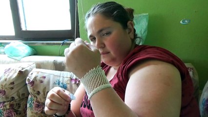 Genç kızın vücudu iğne üretiyor