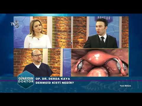Dermoid Kist Nedir ve Nasıl Tedavi Edilir? | Günaydın Doktor