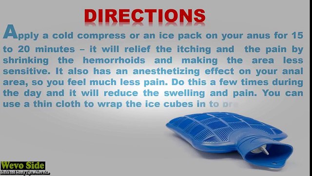 How to get rid of external and internal hemorrhoids naturally, fast and permanently in 48 hours | Hemorrhoid Treatment