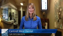 Cantrell West Dental Little Rock         Great         Five Star Review by Joan Carol