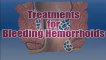 Bleeding Hemorrhoids Treatment - How To Stop Bleeding Hemorrhoids || Treating Hemorrhoids At Home | Hemorrhoid Treatment