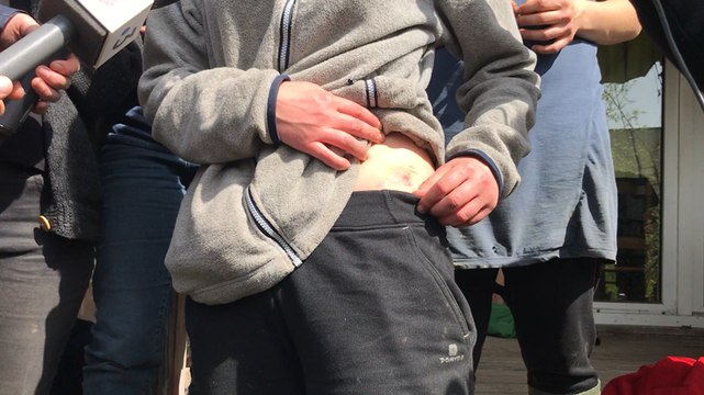 NDDL. L’état des lieux des blessés côté zadistes