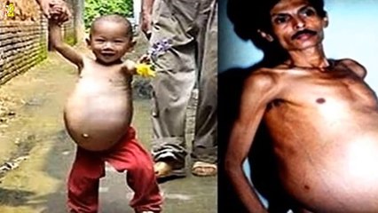 أشياء مذهلة اكتُشِفَت داخل جسم الإنسان