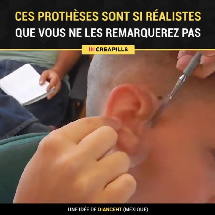 Le réalisme de ces prothèses va vous bluffer... nez, main, doigts!