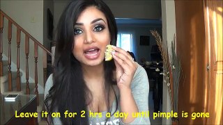 5 Ways to Get Rid of Pimples FAST