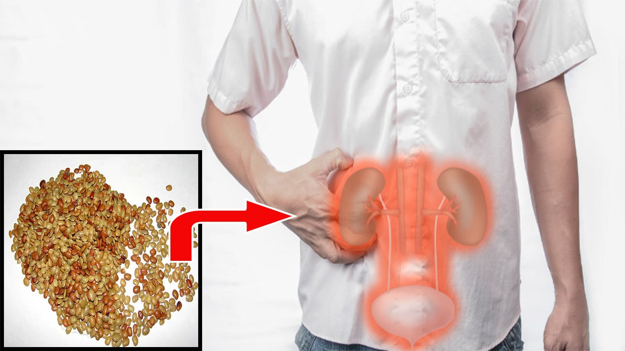 Kidney Stone treatment with Kulthi | पथरी से पाना है छुटकारा तो जल्द से जल्द अपनाएं कुल्थी | Boldsky