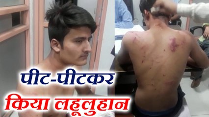 लखनऊ : इंटर के छात्र की बेरहमी से पिटाई, घाव बयां कर रहे दरिंदगी की कहानी
