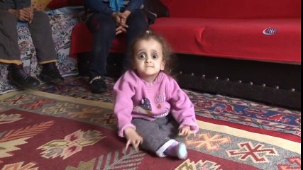 100 Binde 1 Kişide Görülen Hastalıkla Mücadele Ediyorlar