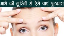 Forehead Wrinkles को इन टिप्स से दूर करें | Tips to get rid of forehead wrinkles | Boldsky