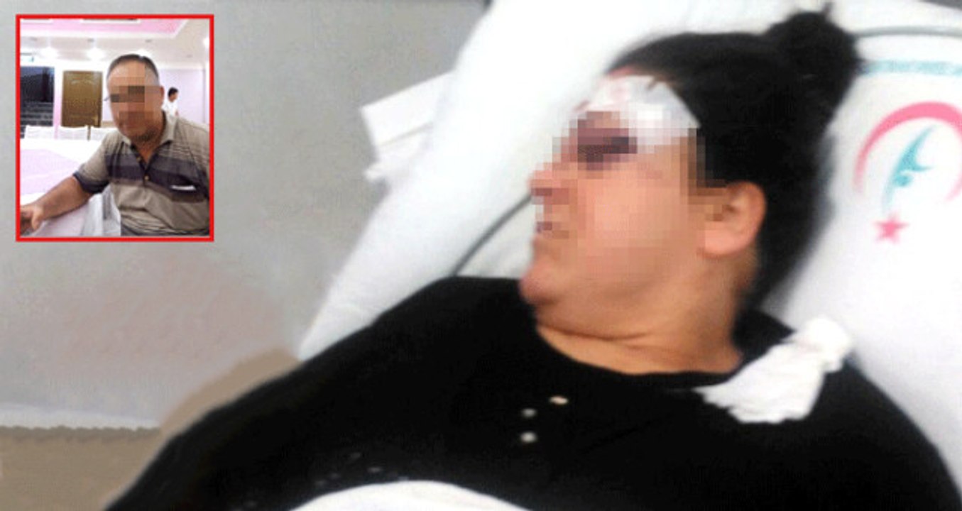 Cani Koca, Boşanma Davası Açan Karısına Tornavida ile Saldırdı