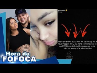 Baixaria! ROB KARDASHIAN expõe TRAIÇÕES de BLAC CHYNA; Ela o ACUSA de AGRESSÃO
