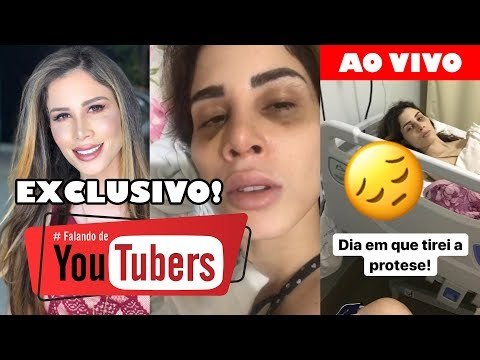 ENTREVISTA: CAMILLA UCKERS conta TUDO sobre as COMPLICAÇÕES de sua CIRURGIA PLÁSTICA