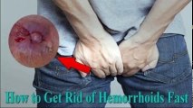 Get Rid Of Hemorrhoids Fast - How To Shrink Hemorrhoids Fast - Get Rid Of Hemorrhoids Fast | Hemorrhoid Treatment