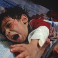 Opinion: Chemical attack survivor on why Syria needs our attention