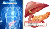 [Happyday]Pancreatic cancer, early detection is   difficult ?! 췌장암, 조기 발견 어렵다?! [기분 좋  은 날]20180416