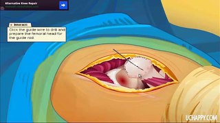 Virtual Hip Surgery - Android - Walkthrough, Guide, Review