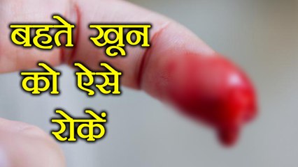 खून बहना इन घरेलू नुस्खों से ऐसे रोकें | Stop Bleeding Faster | Boldsky