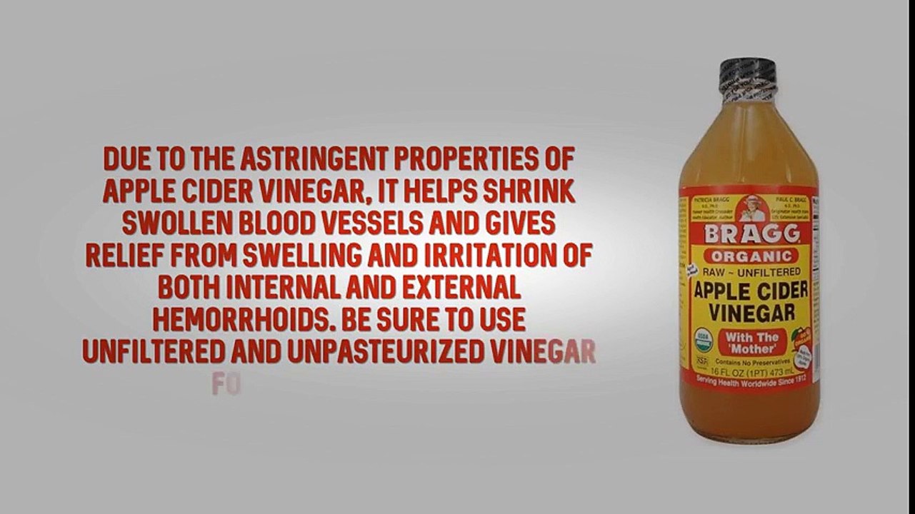 How to stop internal hemorrhoid bleeding – Natural remedies | Hemorrhoid Treatment