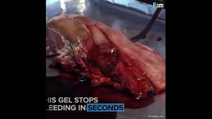 Bu jel kanamayı saniyeler içinde durduruyor!