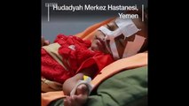 Savaş, abluka, kolera ve açlığın pençesinde bir ülke: Yemen