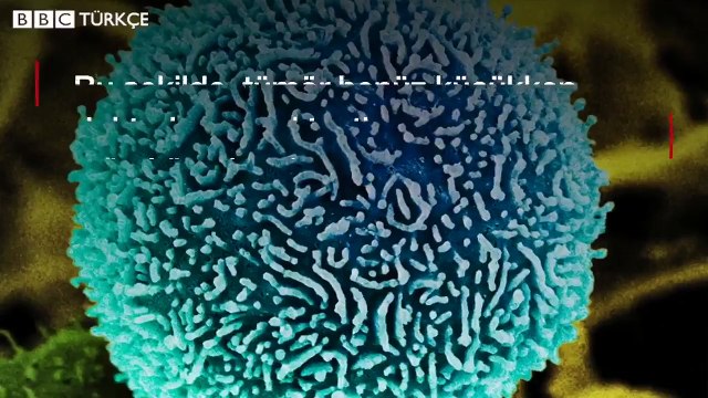 Bu 'selfie' pankreas kanserini teşhis ediyor!