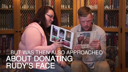 Ölen kocasının yüzünün nakledildiği adamla karşılaştı...