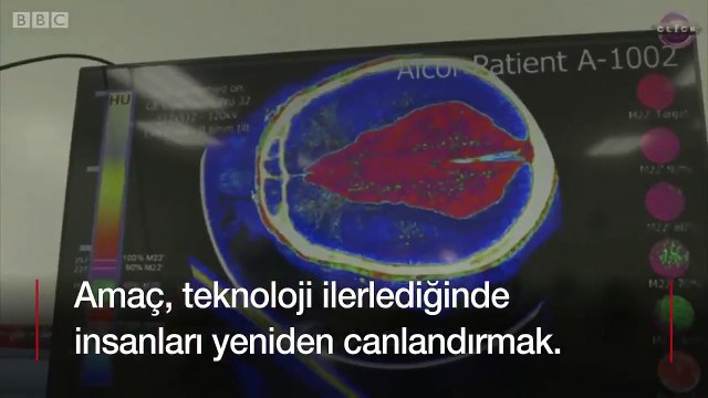 Sonsuza kadar yaşamak ister misiniz?