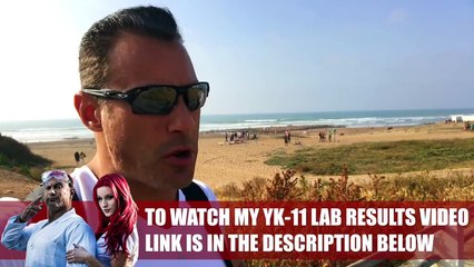 YK 11 Liver Toxicity Lab Results