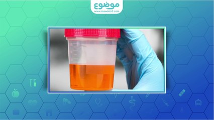 ما سبب تغير لون البول